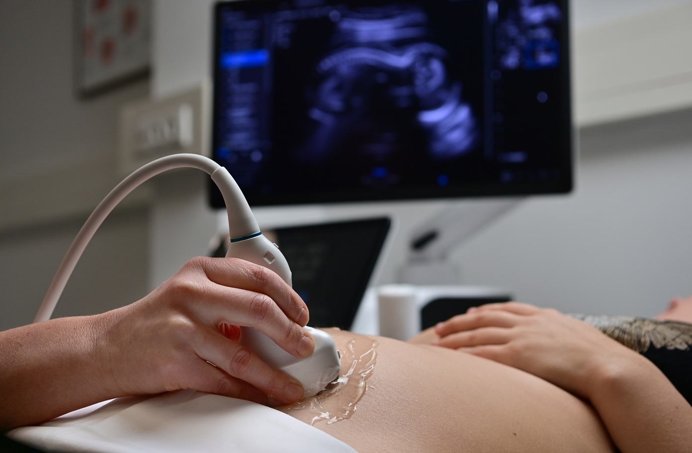 Echografie Gyn/Obst